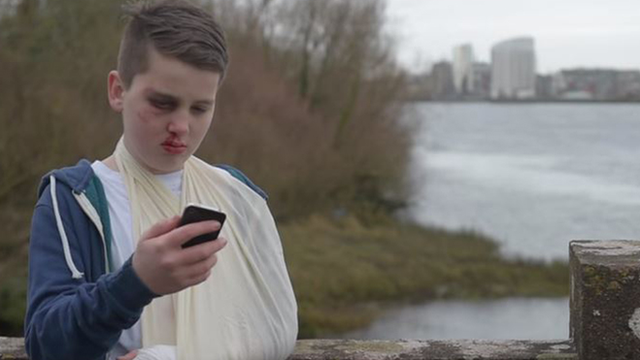 Boy with fake blood makeup holding phone