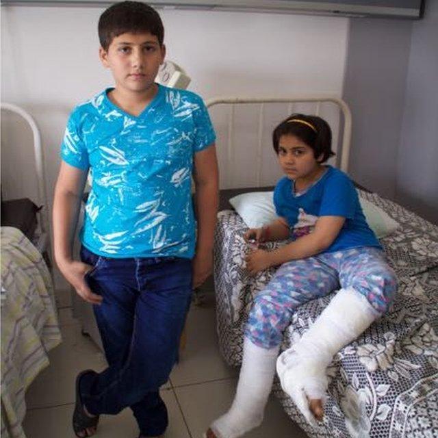 Mohammad Amer, 14, and Mayar, 9, lost their mother and baby brother in a mortar attack, September 2016