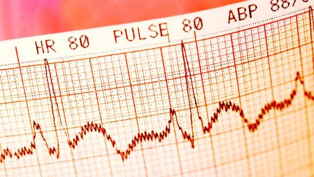 ECG pulse trace