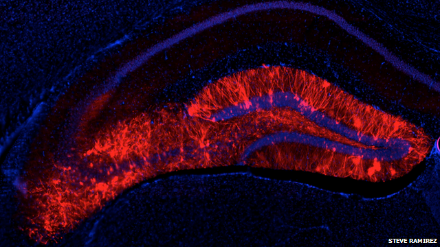 labelled brain cells in hippocampus