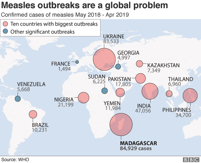 World map of largest measles outbreaks in past year