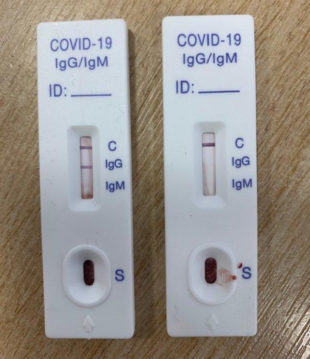 Two antibody tests - one positive one negative