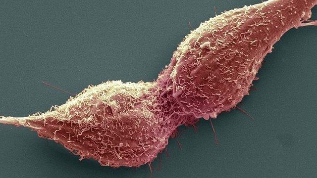 Dividing prostate cancer cells seen through scanning electron micrograph