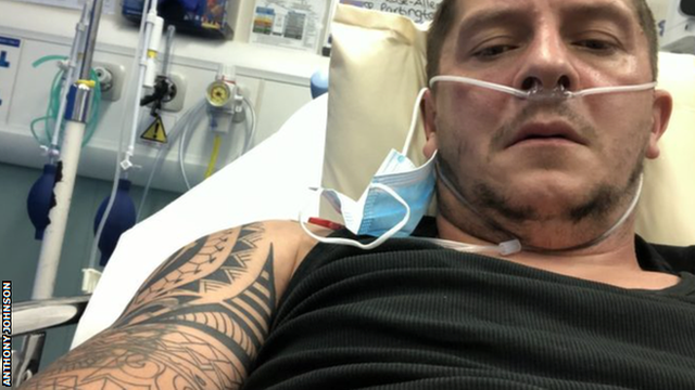 Chester joint manager Anthony Johnson lies in a hospital bed after testing positive for coronavirus