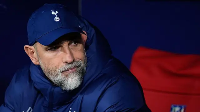 Igor Tudor looks on 