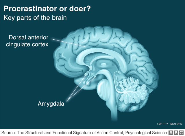 Procrastinator or doer?