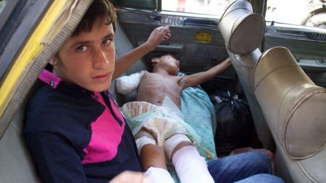 Hani Jadid, 8, lies in a taxi to be taken from hospital, Aleppo, September 2016