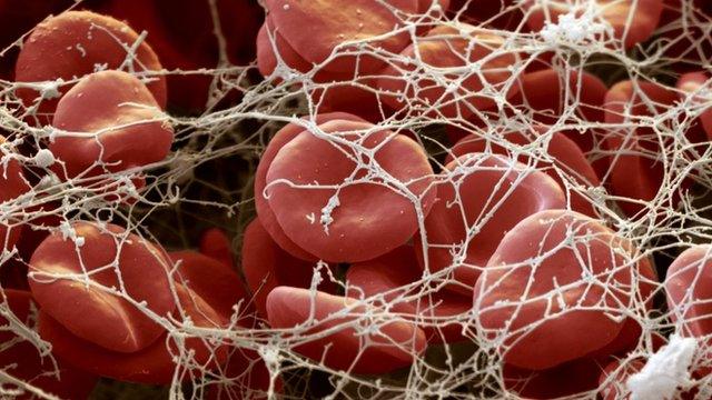 Red blood cells in a blood clot