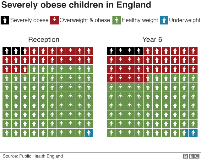 Childhood obesity graphic