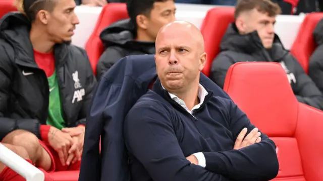 Arne Slot, Manager of Liverpool, looks on prior to the Premier League match between Liverpool FC and Brentford FC at Anfield on August 25, 2024