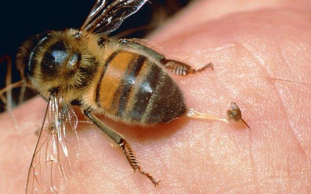 honeybee stinging a finger