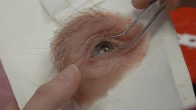 Prosthetic eye