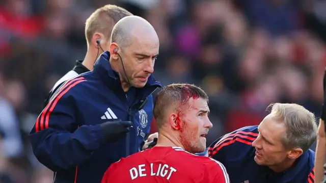 Matthijs de Ligt of Manchester United receives treatment off the pitch for a head injury during the Premier League match between Manchester United FC and Brentford FC at Old Trafford