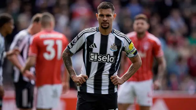 Bruno Guimareas stands with his hands on his hips during a game for Newcastle against Nottingham Forest