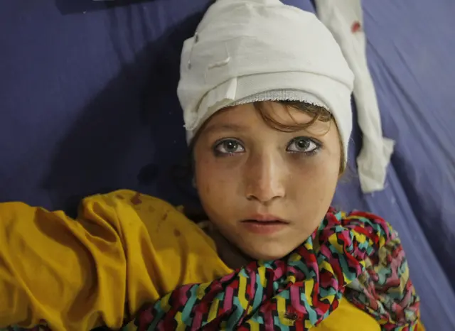 Girl receiving treatment in Peshawar