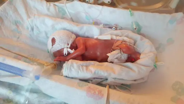 Baby Alfie