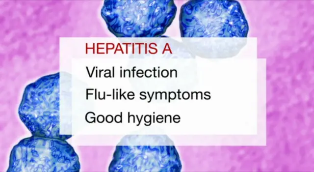 Hepatitis A graphic