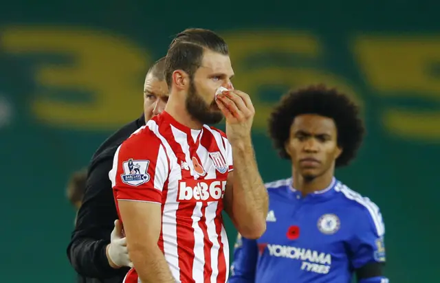 Erik Pieters of Stoke has an injury to his face