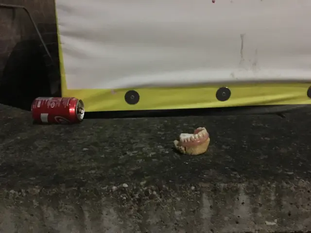 false teeth on Sidney Street