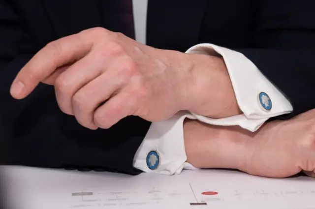 David Cameron's Queen cufflinks