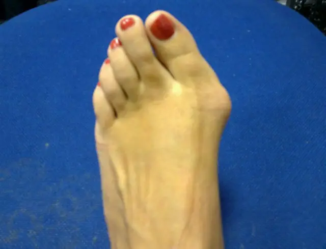 Foot