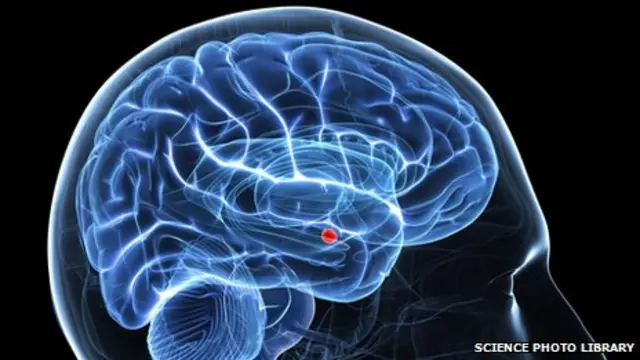 Individuals with autism have less activity in the amygdala (shown in red), which plays a key role in processing emotions