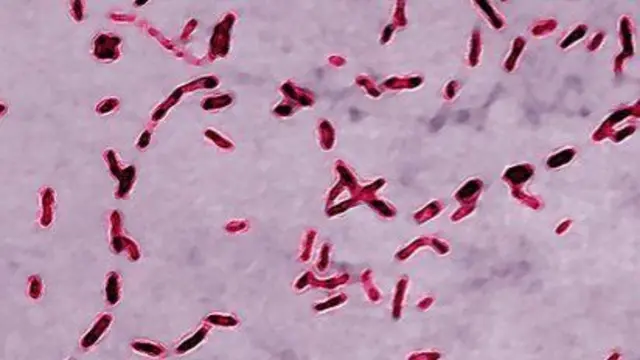 Whooping cough bacteria