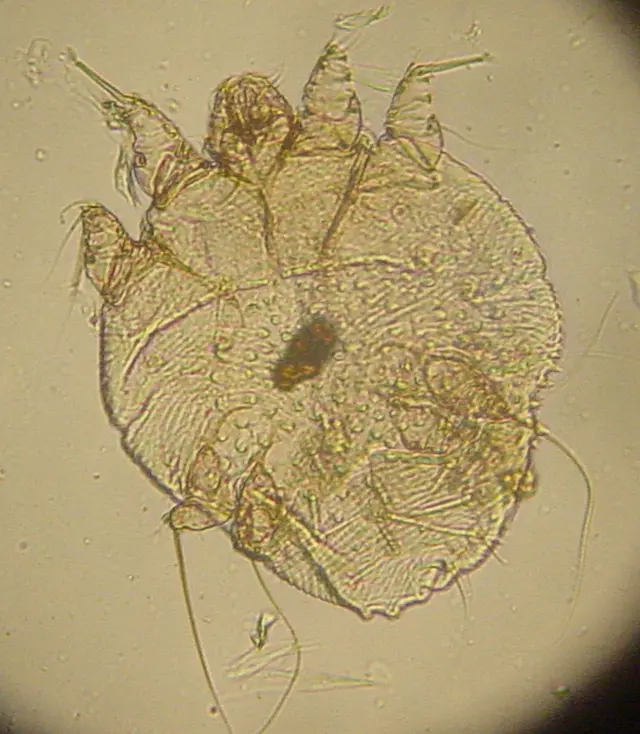 Scabies mite