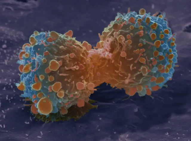 Lung cancer cells