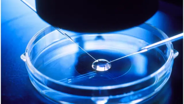 IVF treatment