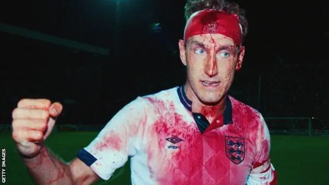 A blood-stained Terry Butcher in an England shirt