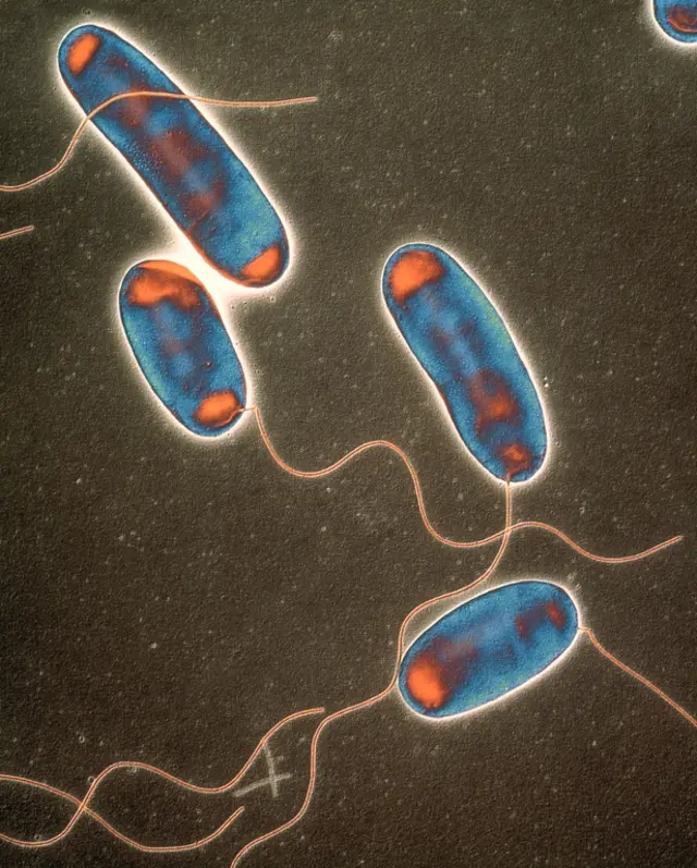 Legionella bacteria
