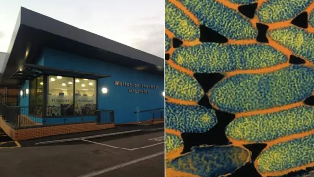 Lifestyles centre/Legionella bacteria