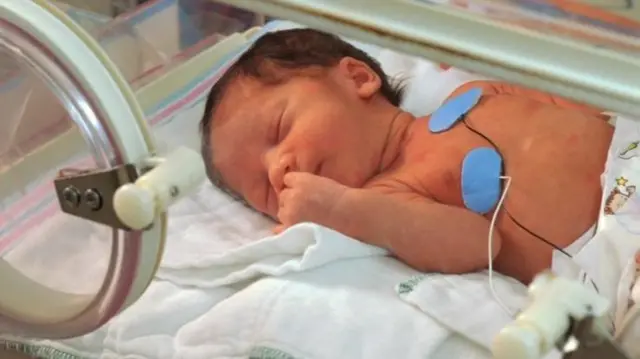 Baby in incubator