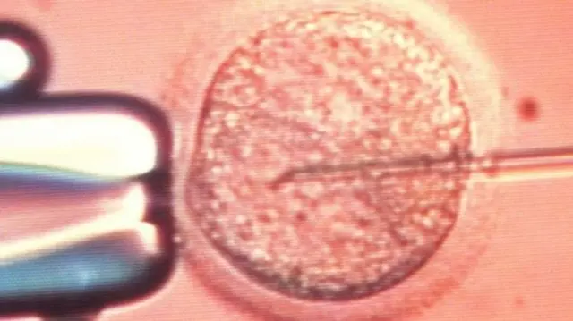 IVF treatment