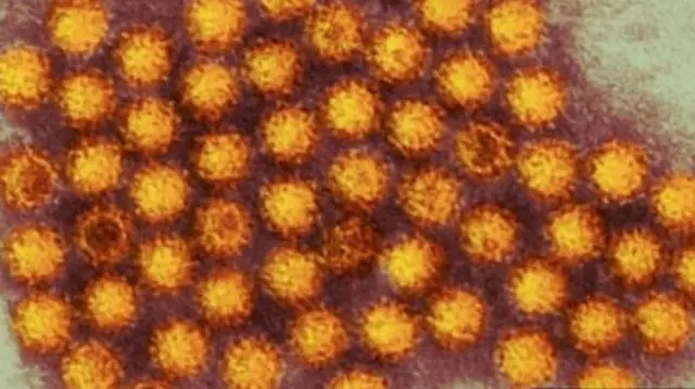 Norovirus