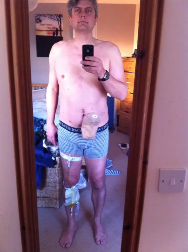 Kurt Jewson prostate picture goes viral