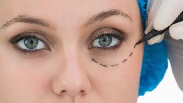 Surgeon drawing a dotted line on a woman's face