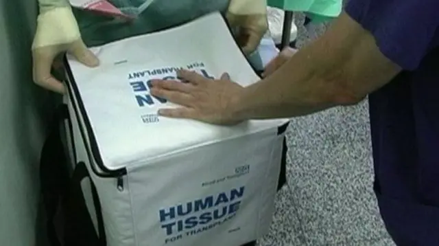 Nurses holding organ bag