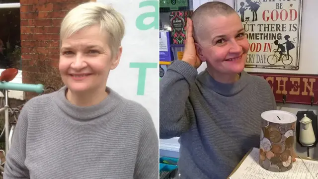 Anna Matthews before and after she had her head shaved