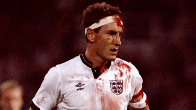 Terry Butcher