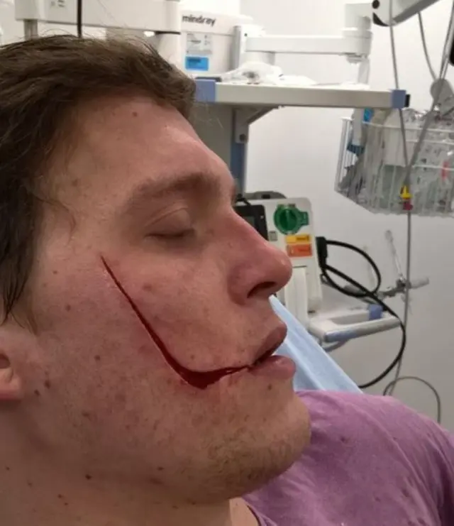 The injured man