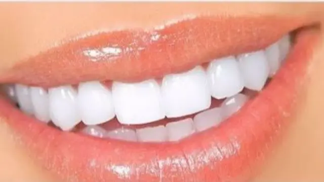 White teeth