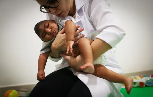 Dr with a child born with a small brain