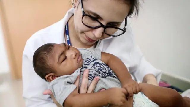 Baby born with small brain