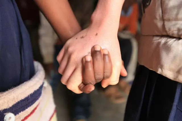 An albino holds hands with her best friend - archive photo