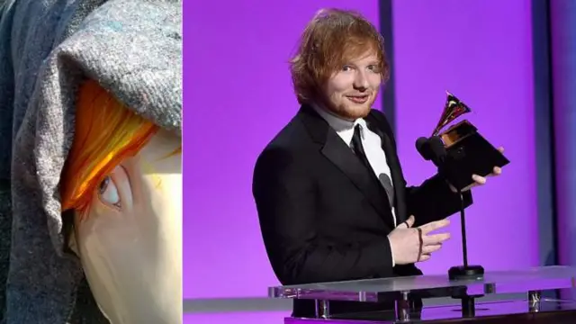 Ed Sheeran and pig