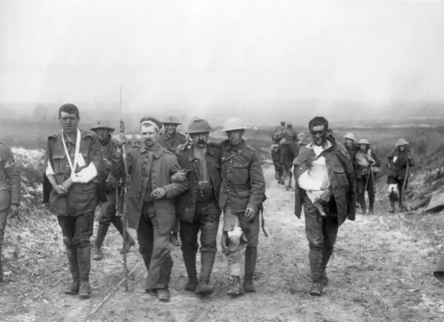 Wounded British soldiers