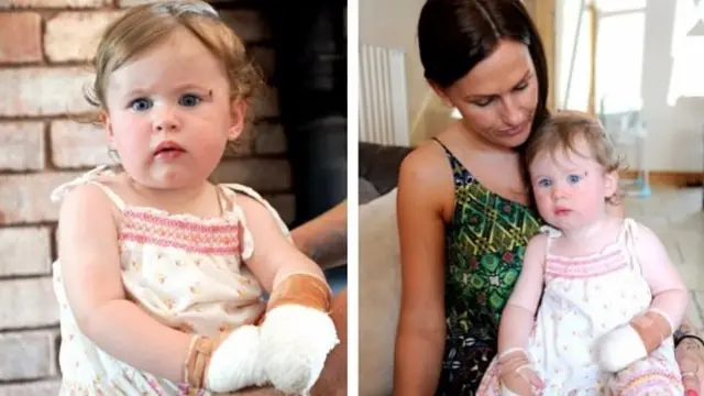 Eva Carrington with bandages on and with mother Lucy Brown