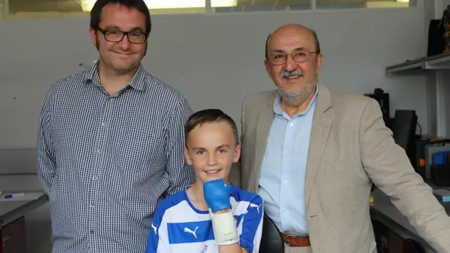 Eight-year-old William with the men who made his new hand